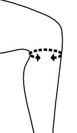 Kniebandage mit Seitenschienen